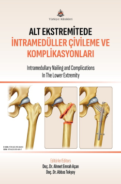 altekstremitedeintrameduller-kapak