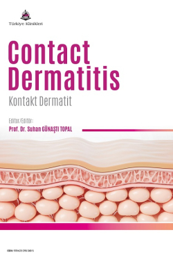 contact-dermatitis