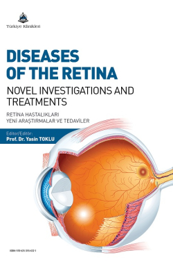 retinaldiseaseswos_kapak